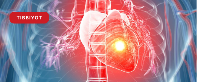 Yurak tomirlarini tozalash